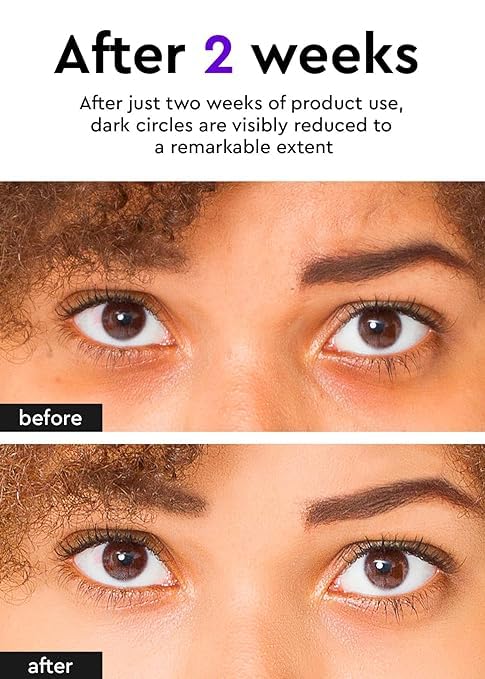 Bewants Instant Eye Bag Remover for Puffiness, serum roller for dark circles and puffiness, under eye treatment with bamboo water, Vegan Collagen (1 Pack)