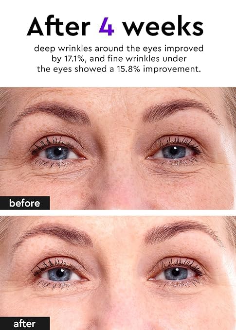 Bewants Instant Eye Bag Remover for Puffiness, serum roller for dark circles and puffiness, under eye treatment with bamboo water, Vegan Collagen (1 Pack)