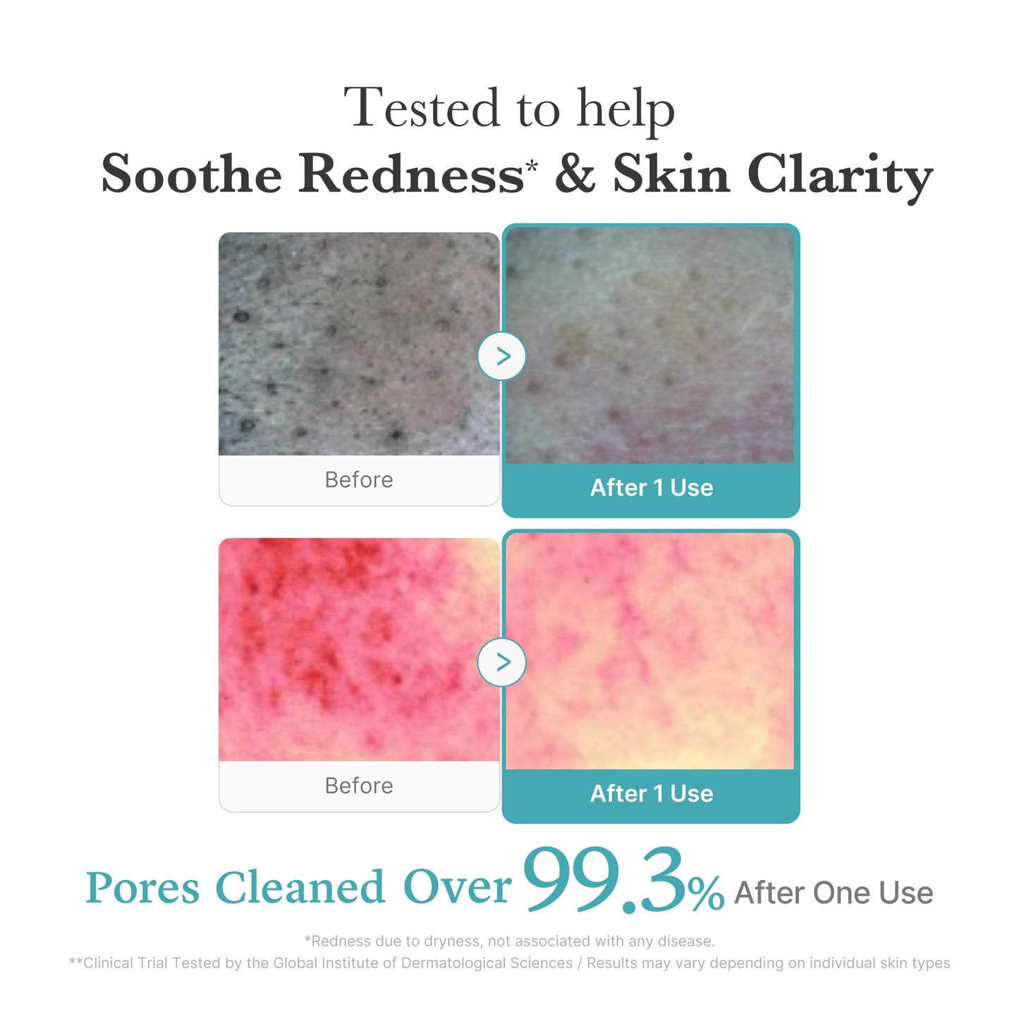 medicube Zero Pore Clear Blue Capsule Facial Deep Cleanser for Skin Texture, Blackhead & Pore Care | AHA, BHA & PHA for Double Cleansing, Daily Gentle Face Wash, Korean Skincare | 120g / 4.23 oz