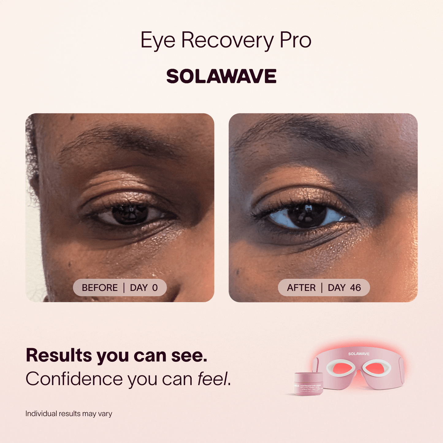 Solawave Eye Recovery Pro Kit Brightens Dark Circles