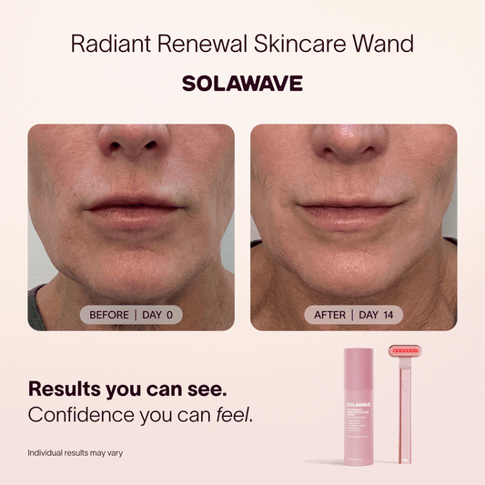 4 In 1 Red Light Therapy Wand And Activating Serum Kit
